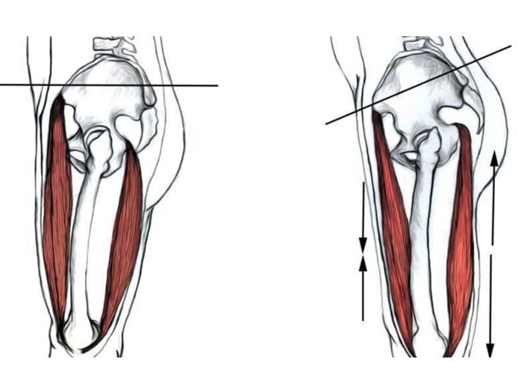 hip muscles